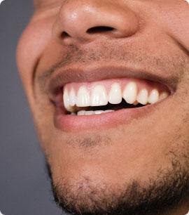 Gum Health Image