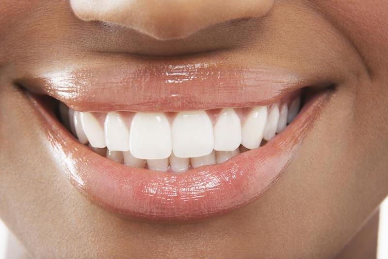 Lingual Braces